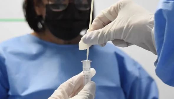 RJ: cenário epidemiológico de covid-19 tem tendência de redução