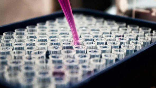 Estudo mostra que inflamação no cérebro pode ser chave do Alzheimer