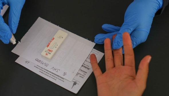 HIV/Aids: Brasil vai insistir em acordo por PrEP de longa duração