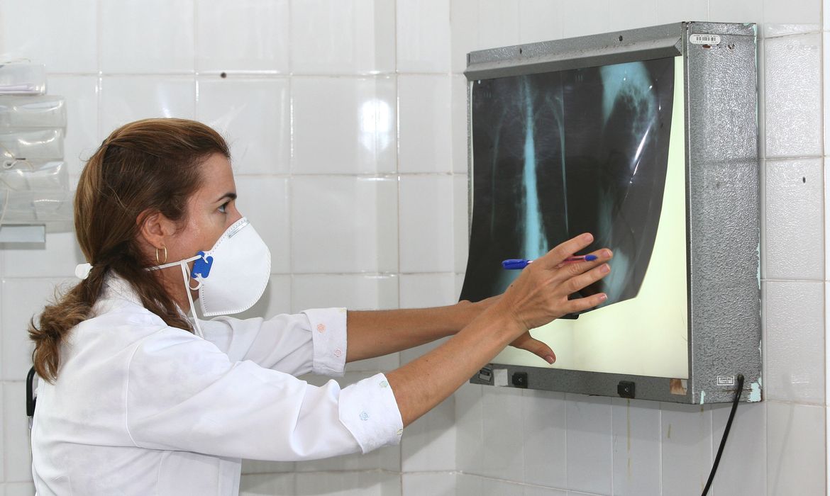OAB Barro Preto - OMS recomenda testes de diagnóstico rápido para erradicar tuberculose