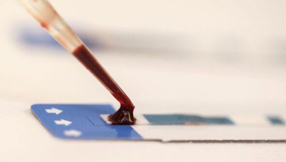 Estudo inédito da Fiocruz pode ampliar prevenção de HIV entre jovens