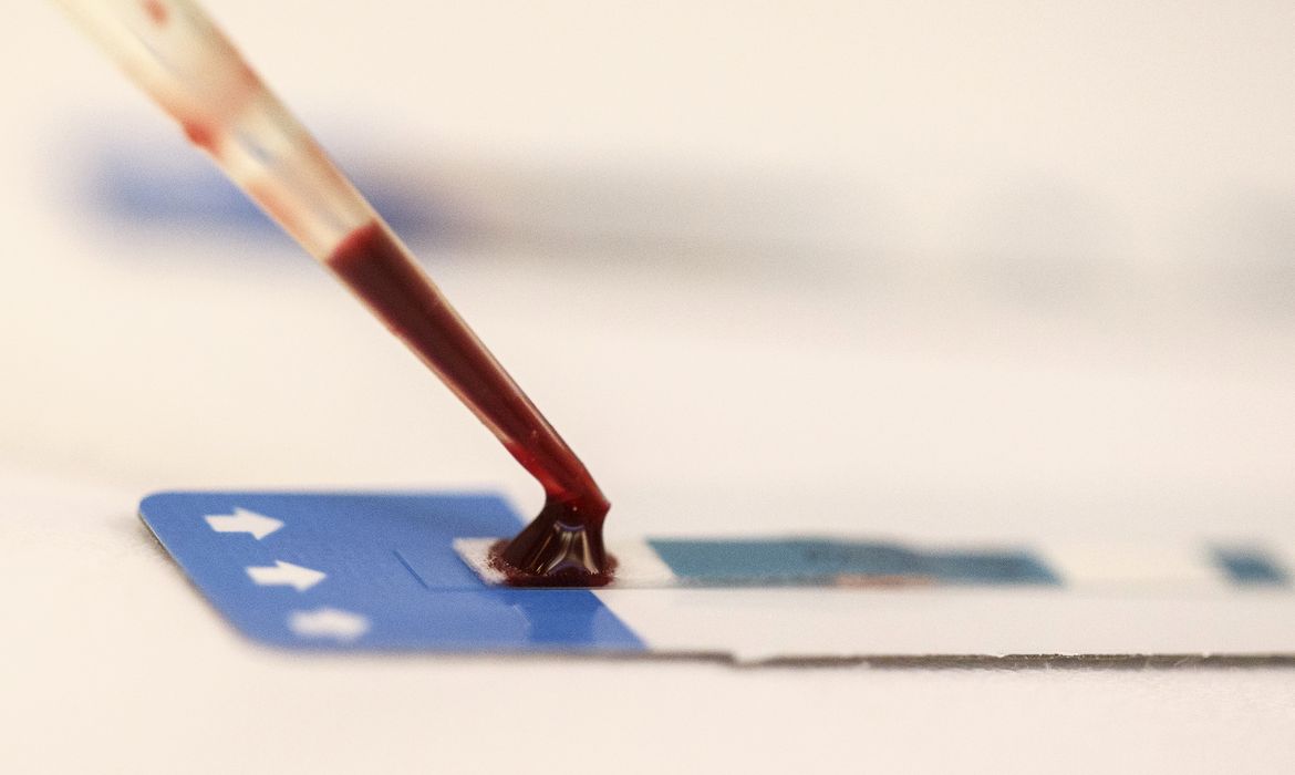 OAB Barro Preto - Estudo inédito da Fiocruz pode ampliar prevenção de HIV entre jovens