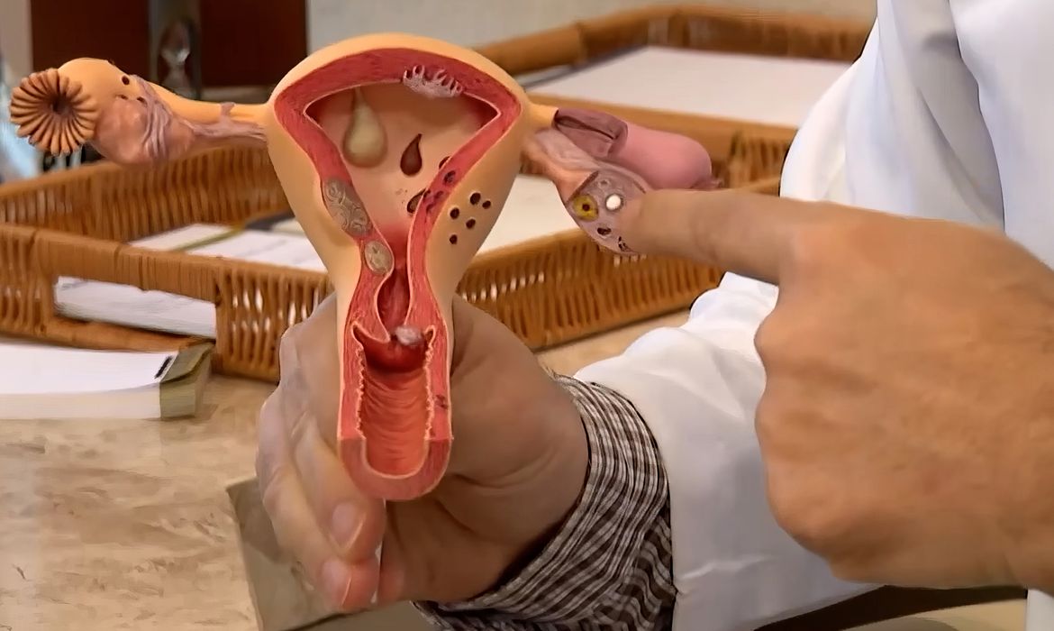 OAB Barro Preto - Aberta chamada pública para pesquisas sobre endometriose
