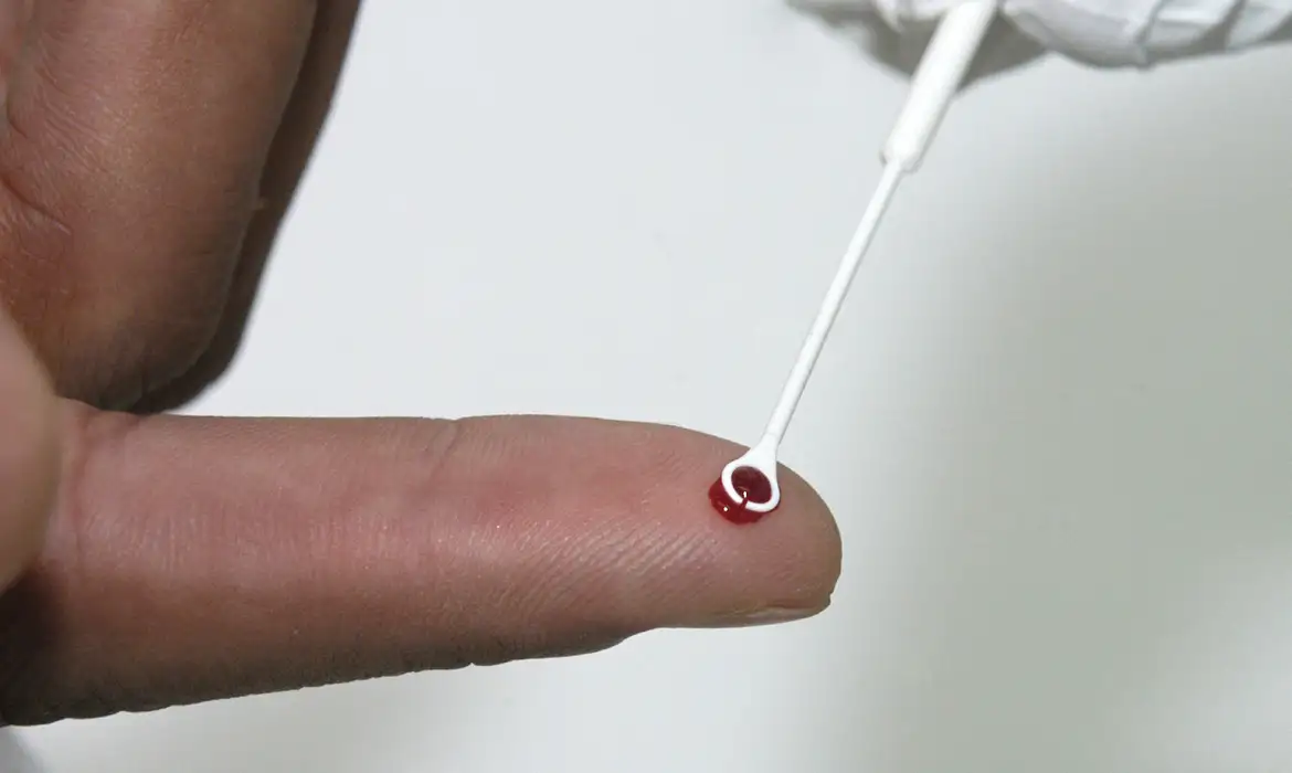 OAB Barro Preto - Fiji declara emergência nacional por HIV com 1 caso a cada 60 pessoas