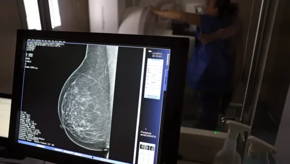 Médicos lançam guia para evitar recusa de mamografia digital